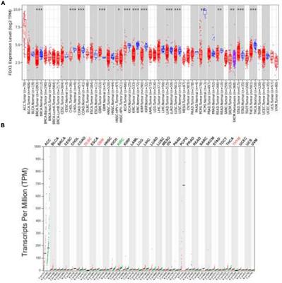 Cuproptosis key gene FDX1 is a prognostic biomarker and associated with immune infiltration in glioma